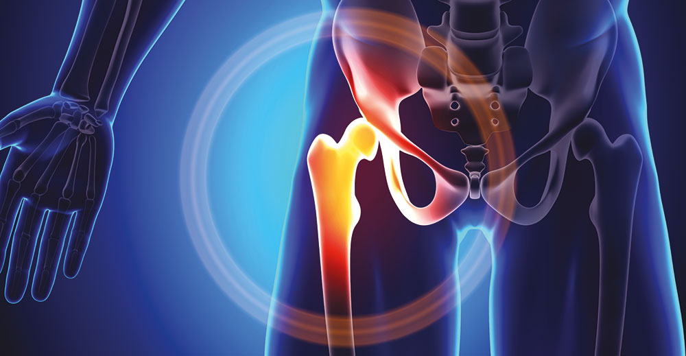 Orthopaedic Surgery - Hip and Knee | Parkside Suite Heatherwood | Providing patients with private healthcare of the highest quality | Parkside Suite - a leading NHS Foundation Trust | Ascot, Berkshire | Tel: 0300 6144183