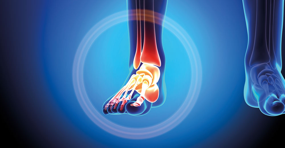 Orthopaedic Surgery - Foot and Ankle | Parkside Suite Heatherwood | Providing patients with private healthcare of the highest quality | Parkside Suite - a leading NHS Foundation Trust | Ascot, Berkshire | Tel: 0300 6144183