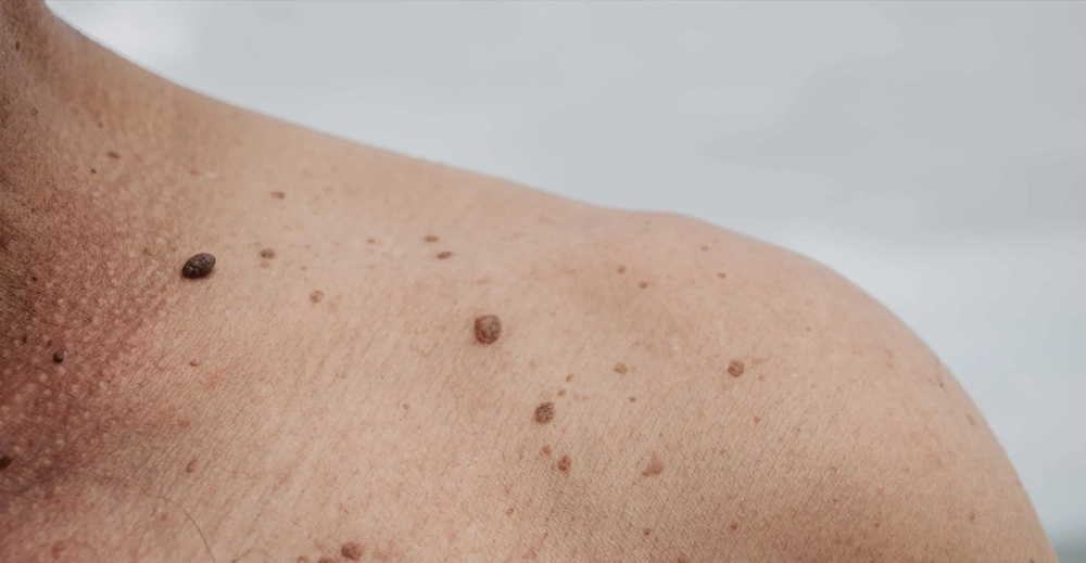 Dermatology and Surgical Clinic at Parkside Suite Heatherwood