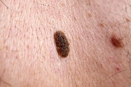 Dermatology and Surgical Clinic at Parkside Suite Heatherwood