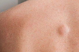 Dermatology and Surgical Clinic at Parkside Suite Heatherwood